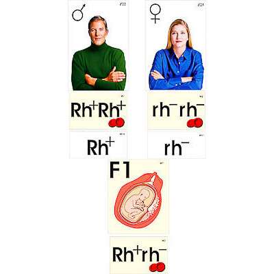 Модель-аппликация "Наследование резус-фактора" (ламинированная)