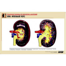 Рельефная таблица "Почка. Фронтальный разрез" (формат А1, матовое ламинир.)